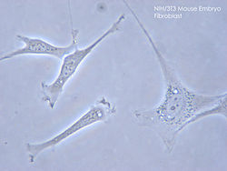 fibroblast-cell-culture
